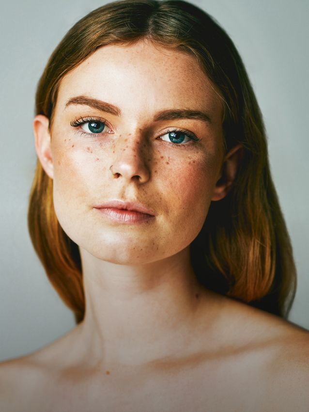 Injectables & Fillers in Alpharetta, GA